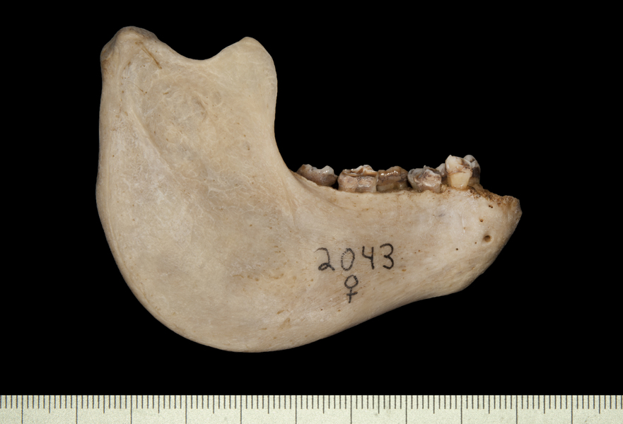 lower_lateral0008