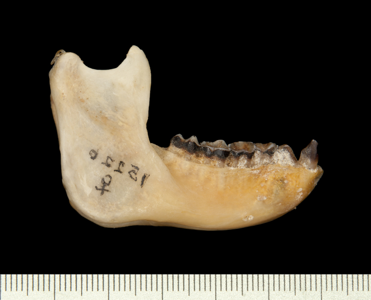 lower_lateral0028